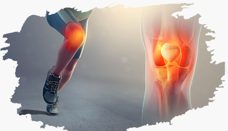 მუხლის სახსრის ფიქსატორი