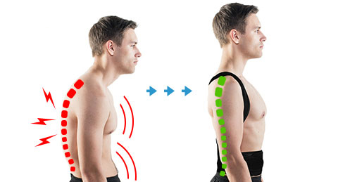 მხრების კორექტორი